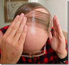 combover2