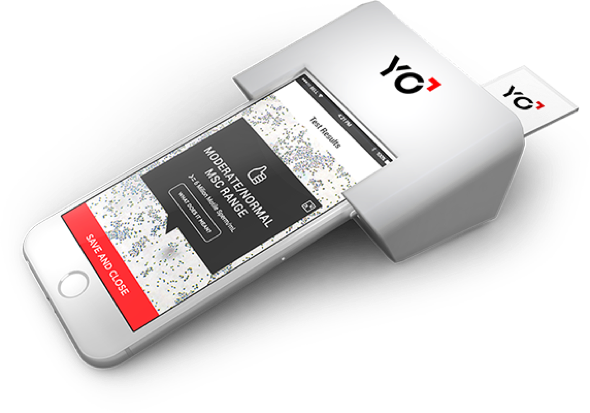 yo_sperm_test_device