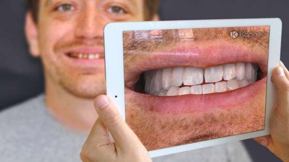 Kapanu Augmented Reality Dentist