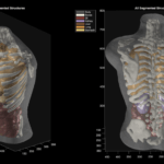 ultrasound_phantom_segmentation_Midjourney_Scanner