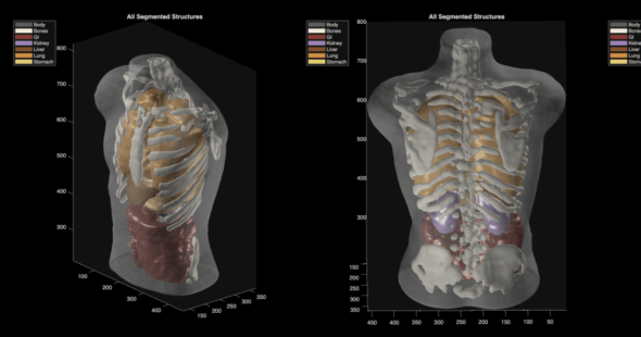 ultrasound_phantom_segmentation_Midjourney_Scanner