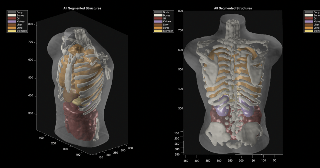 ultrasound_phantom_segmentation_Midjourney_Scanner
