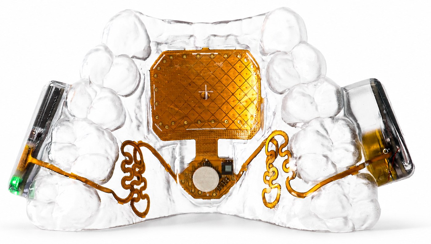 Augmental MouthPad clear custom-fit mouthpiece with its gold trackpad