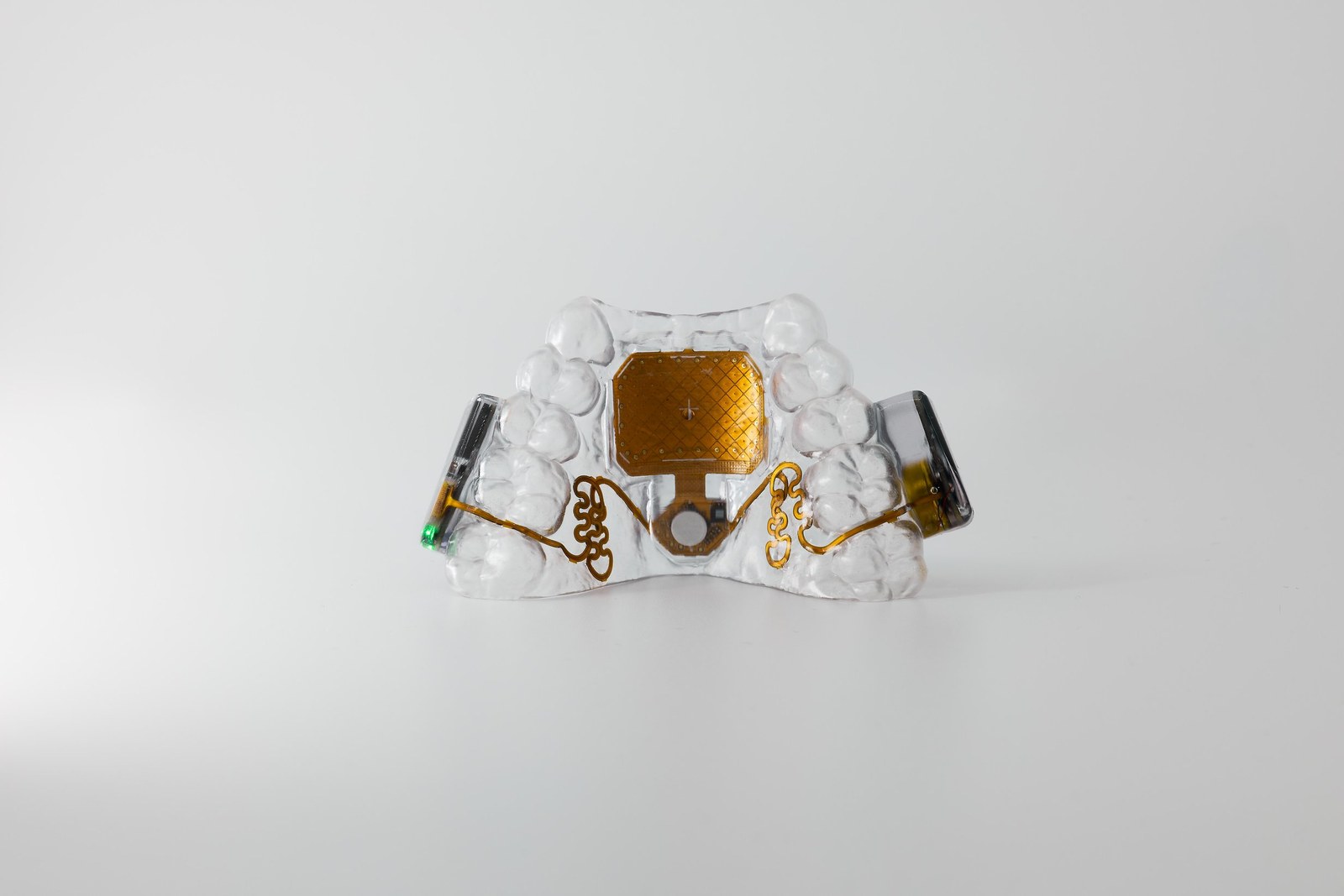 MouthPad mouthpiece with its electronics sealed in clear dental resin